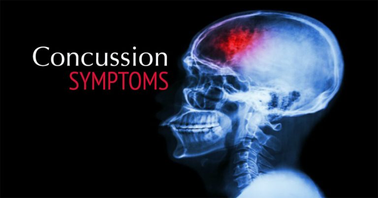 youth sports concussions